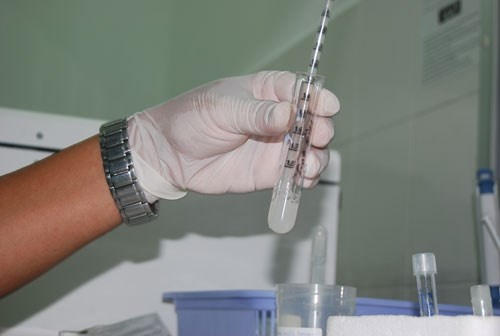 4. Xét nghiệm tinh dịch đồ. Với chú rể, việc xét nghiệm tinh dịch đồ cũng là điều quan trọng và nên làm. Đây là xét nghiệm giúp đánh giá khả năng sinh con của nam giới, nhằm giúp bạn chuẩn bị cho cuộc sống sau đám cưới. Các chú rể tương lai có thể tìm tới những phòng khám nam khoa, bệnh viện để thực hiện xét nghiệm. Trước ngày khám, chú rể nên kiêng đồ uống có cồn cũng như giữ tâm lý, sức khỏe ổn định.