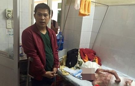 Bo xot xa nhin con rung tung ngon tay vi bong nang toan than hinh anh