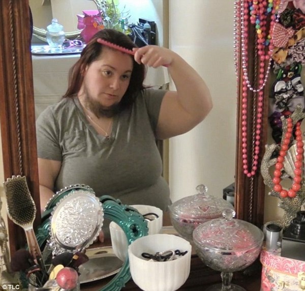 Annalisa Hackleman có râu từ năm 13 tuổi.