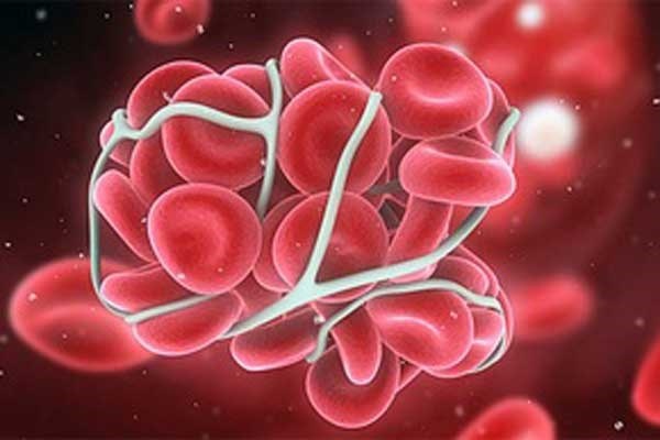 Điều quan trọng cần lưu ý là không phải tất cả các khối u thứ cấp này đều gây ung thư, có thể nó lành tính hoặc ác tính. Sự khác biệt của hai khối u này là lành tính sẽ không di căn và sẽ không tái sinh khi bị loại bỏ. Lúc này, tùy theo kích cỡ, vị trí và hình dạng mà bác sỹ sẽ có quyết định điều trị phù hợp.