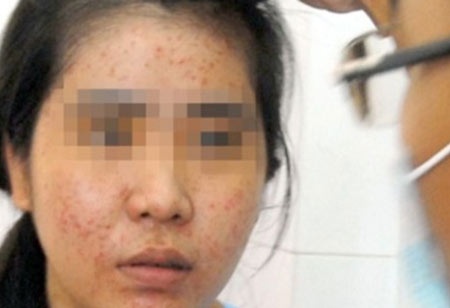 Nhap vien vi lam dep hinh anh