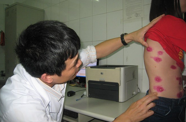 Toan than mung mu vi nang nong hinh anh