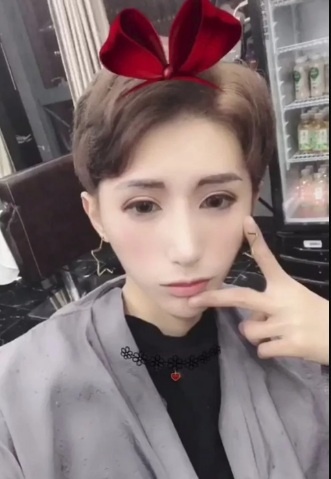 phau thuat tham my anh 4