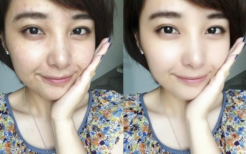 Gioi tre san sang 'dap mat xay lai' de dep nhu hinh selfie hinh anh