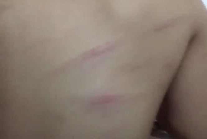 Be gai bi co giao chu nhiem danh bam tim lung vi luoi hoc hinh anh
