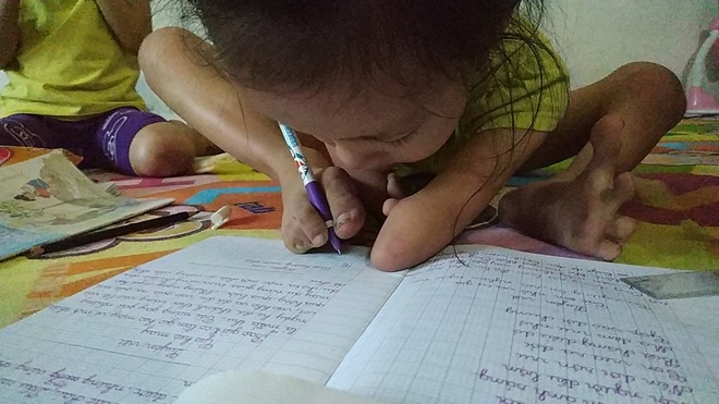 Nghi luc song phi thuong cua co be 'chim canh cut' hinh anh