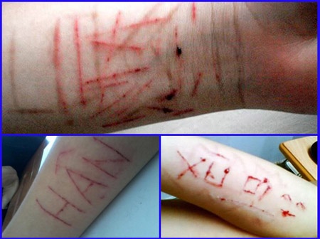 'Nhieu hoc sinh kha, gioi co bieu hien tu huy hoai ban than' hinh anh