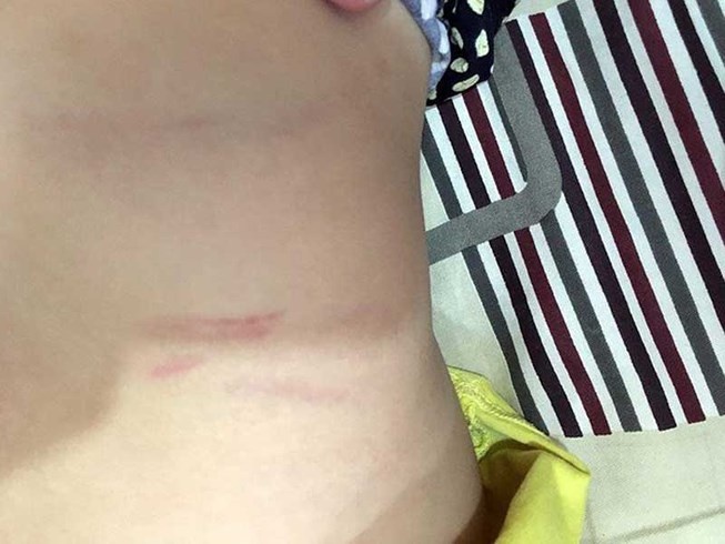 Cô giáo đánh học sinh ảnh 1 Co giao danh hoc sinh anh 1