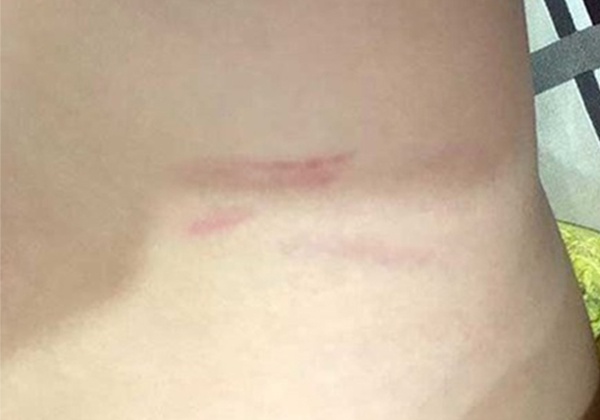 Con bi co giao danh, cha de nghi truong boi thuong 100 trieu dong hinh anh