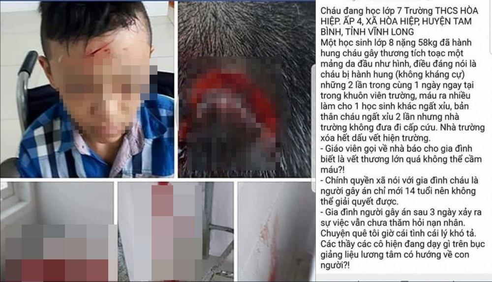 học sinh bị bạn đánh ảnh 1 hoc sinh bi ban danh anh 1