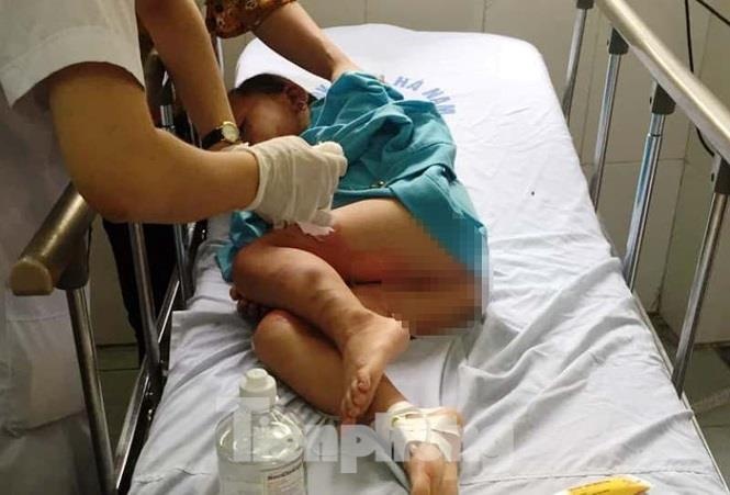 3 tre mam non bong nang anh 2