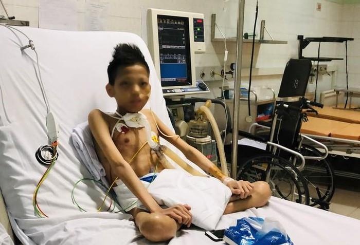 Thieu nien 17 tuoi nang 30 kg duoc ghep phoi voi chi phi 5 ty dong hinh anh