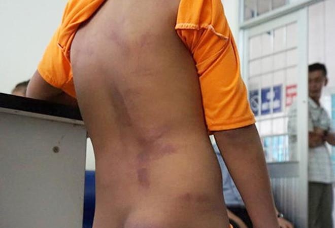 4 học sinh bị đánh ở Cà Mau ảnh 1 4 hoc sinh bi danh o Ca Mau anh 1