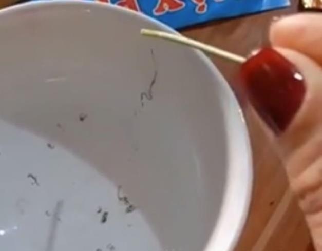 Video gap dong giun trong mat nguoi phu nu Cao Bang len bao Tay hinh anh