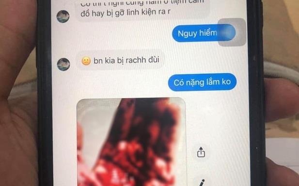 DH Quoc te TP.HCM phu nhan thong tin 2 sinh vien bi cuop, rach dui hinh anh