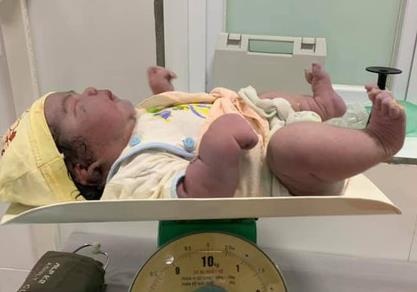 San phu o Nghe An sinh thuong be gai nang 5,5 kg hinh anh