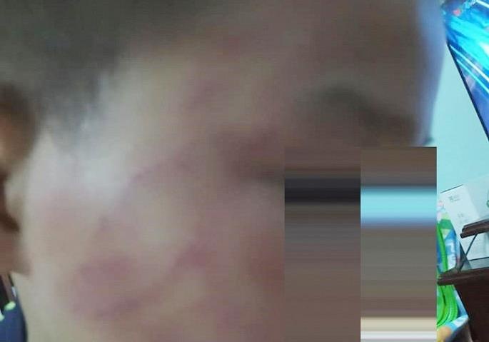 Hoc sinh lop 4 bi thay tat do ma vi nghich trong gio ngu trua hinh anh