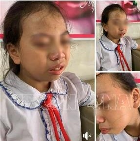 co giao tat hoc sinh lop 4 anh 1