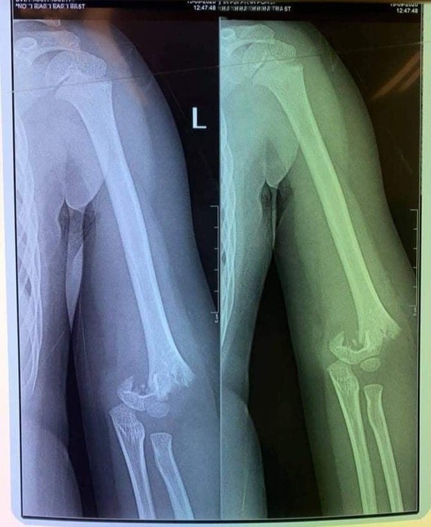 tre mam non gay tay anh 1