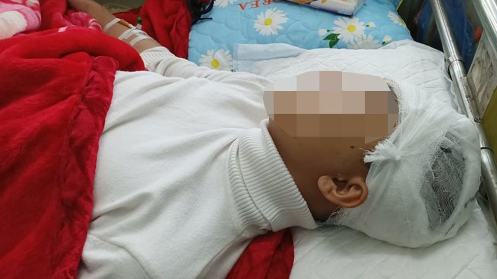 Nam sinh lop 11 chan thuong nang vi bi ban danh hinh anh