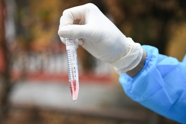 Sinh vien DH Su pham Ha Noi am tinh voi SARS-CoV-2 hinh anh