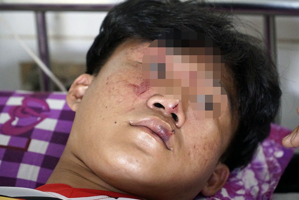 Nhom nguoi la vao truong loi hoc sinh ra ngoai danh hinh anh