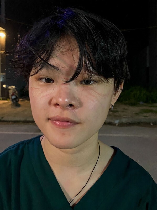 sinh viên ngành y hỗ trợ chống dịch  ảnh 12 sinh vien nganh y ho tro chong dich anh 12