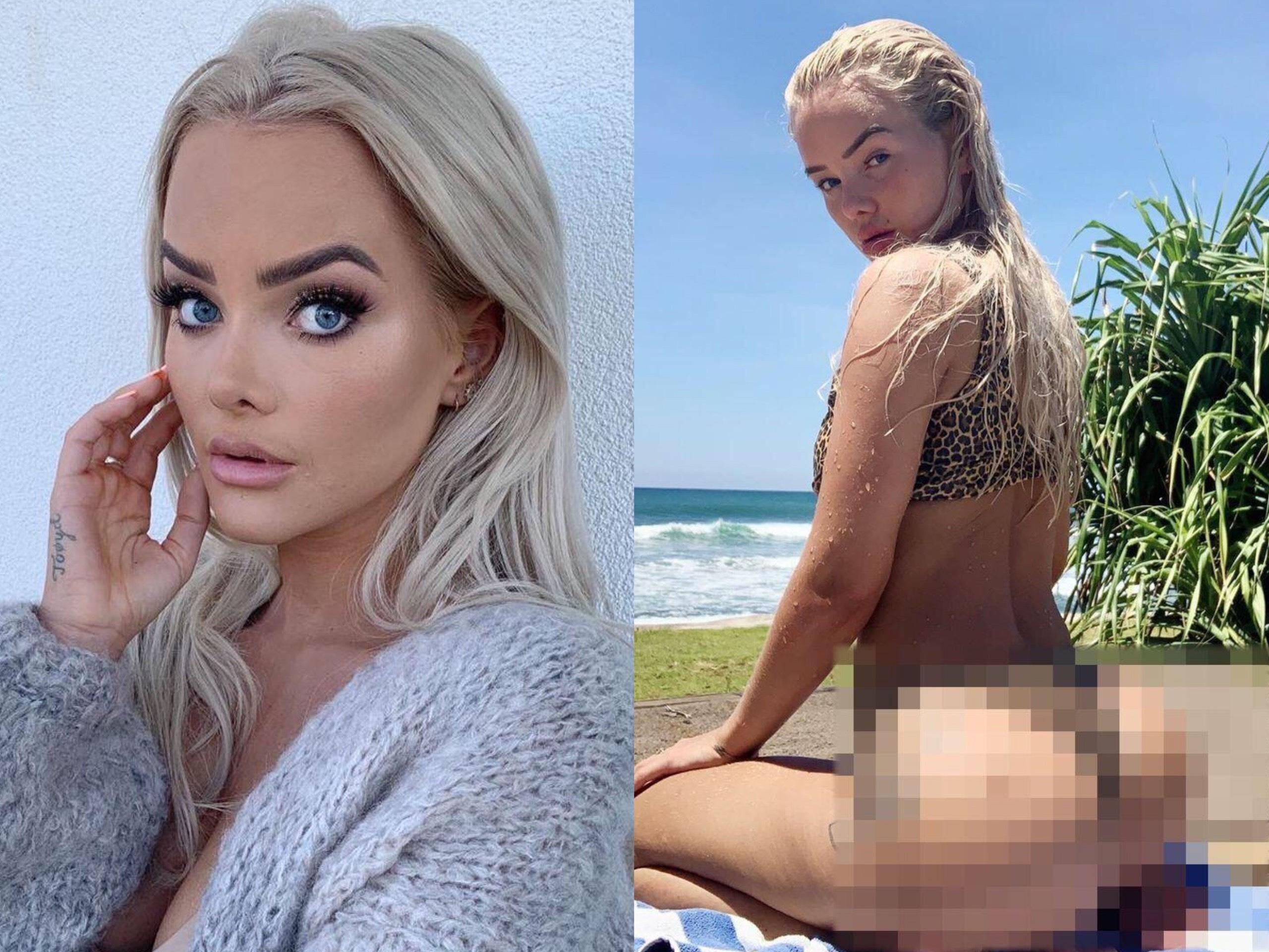 Bom mong gia re, nu ca si My gap rac roi, phai di phau thuat thu hep hinh anh