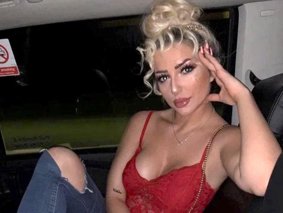 Hot girl tiem filler de co guong mat con nha giau nhu Kylie Jenner hinh anh