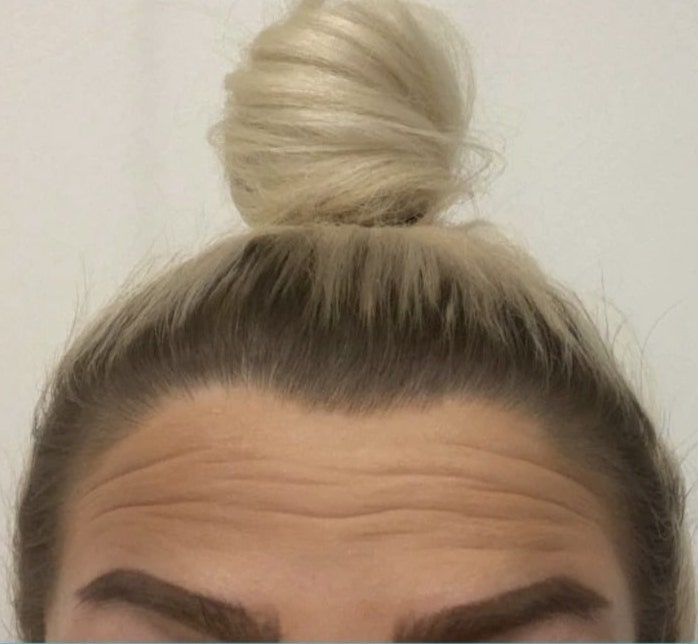 Chi 1000 USD để có ngoại hình giống Kylie Jenner ảnh 3 Chi 1000 USD de co ngoai hinh giong Kylie Jenner anh 3