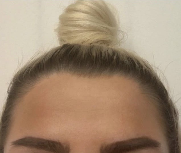 Chi 1000 USD để có ngoại hình giống Kylie Jenner ảnh 4 Chi 1000 USD de co ngoai hinh giong Kylie Jenner anh 4