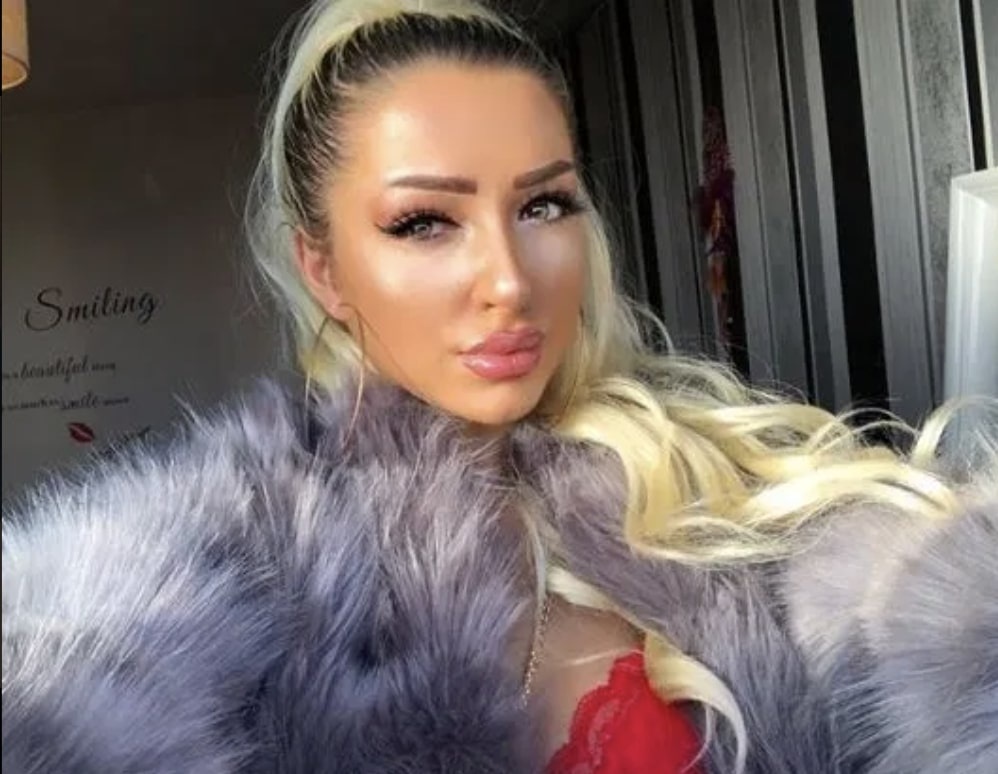 Chi 1000 USD để có ngoại hình giống Kylie Jenner ảnh 6 Chi 1000 USD de co ngoai hinh giong Kylie Jenner anh 6