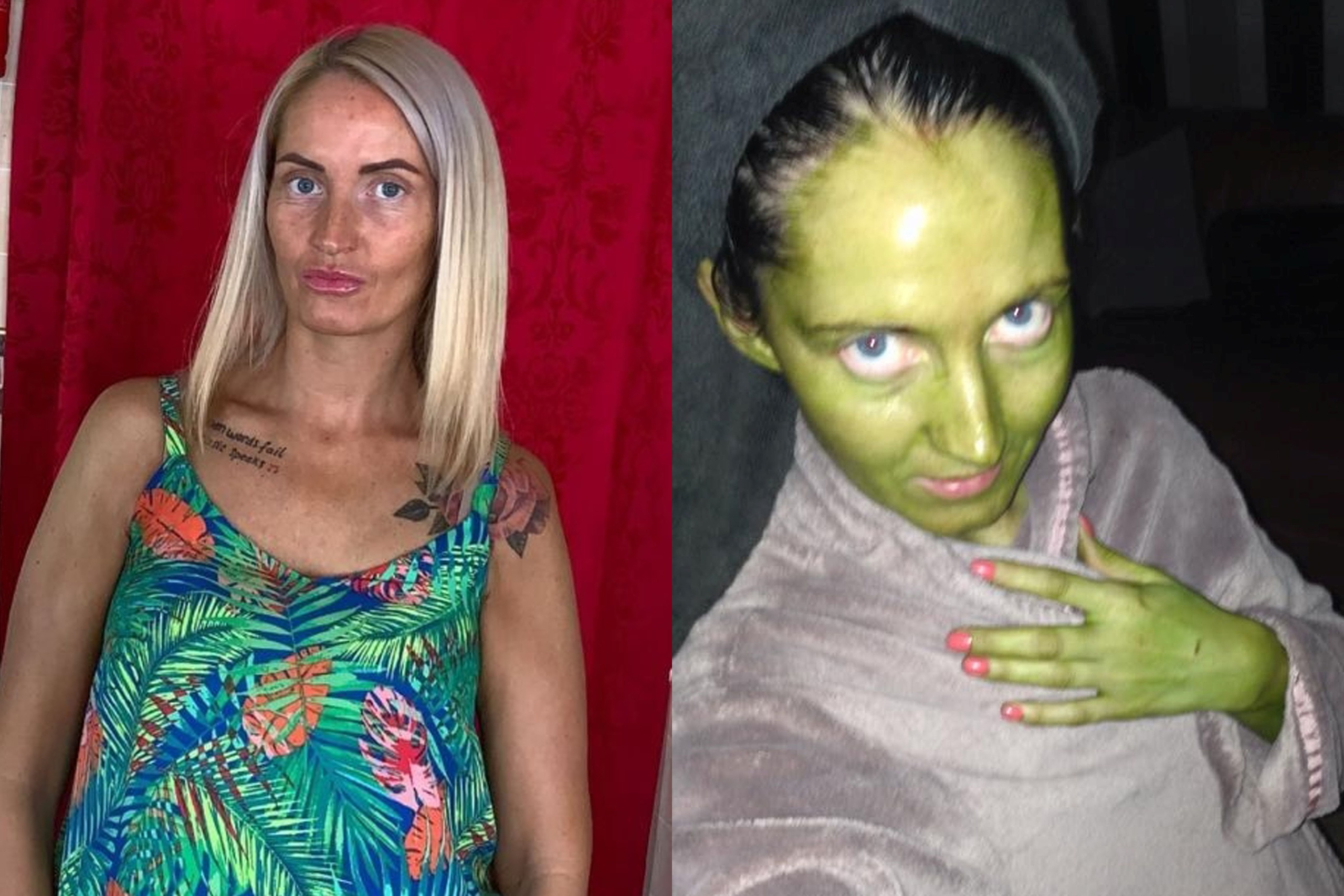 Co gai bi xanh da vi su dung my pham het han hinh anh