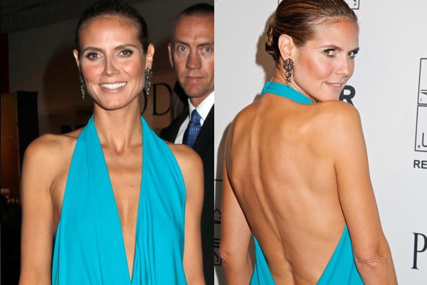 Sieu mau noi y bi chan an, gay tro xuong vi suot ngay giam can hinh anh