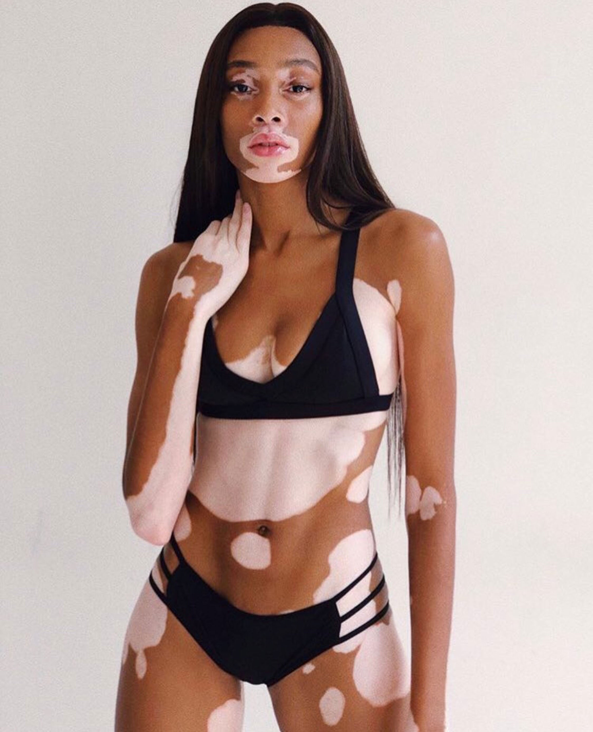 Winnie Harlow hẹn hò hot boy bóng rổ ảnh 3 Winnie Harlow hen ho hot boy bong ro anh 3