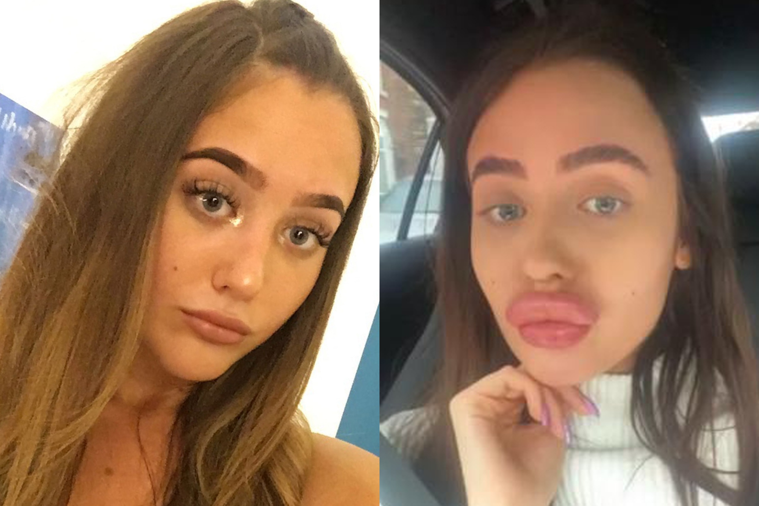 Nu tiep vien bi sung phong moi sau trai nghiem lam dep dau don hinh anh