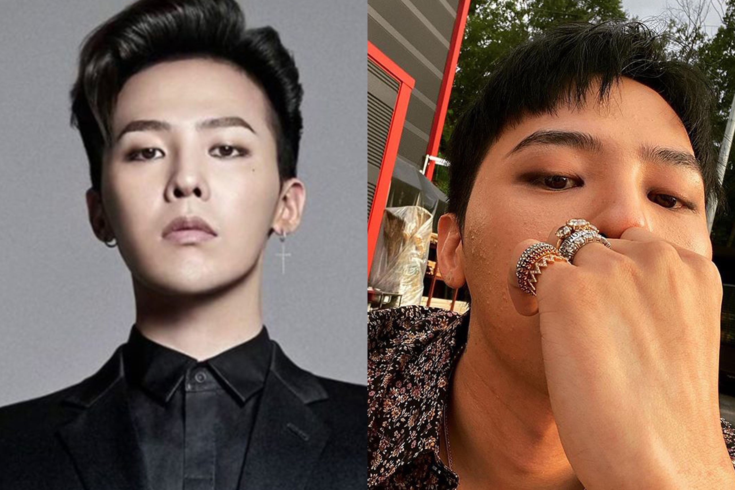 Vi sao mat G-Dragon len nhieu mun? hinh anh