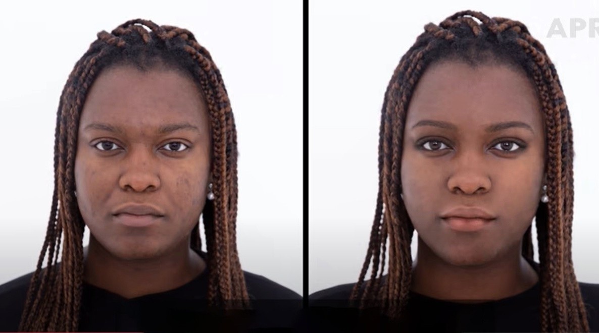 Chinh sua guong mat co gai Tay theo tieu chuan Han Quoc hinh anh