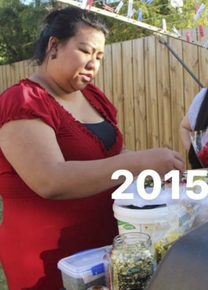 giảm 54 kg nhờ cắt dạ dày ảnh 1 giam 54 kg nho cat da day anh 1