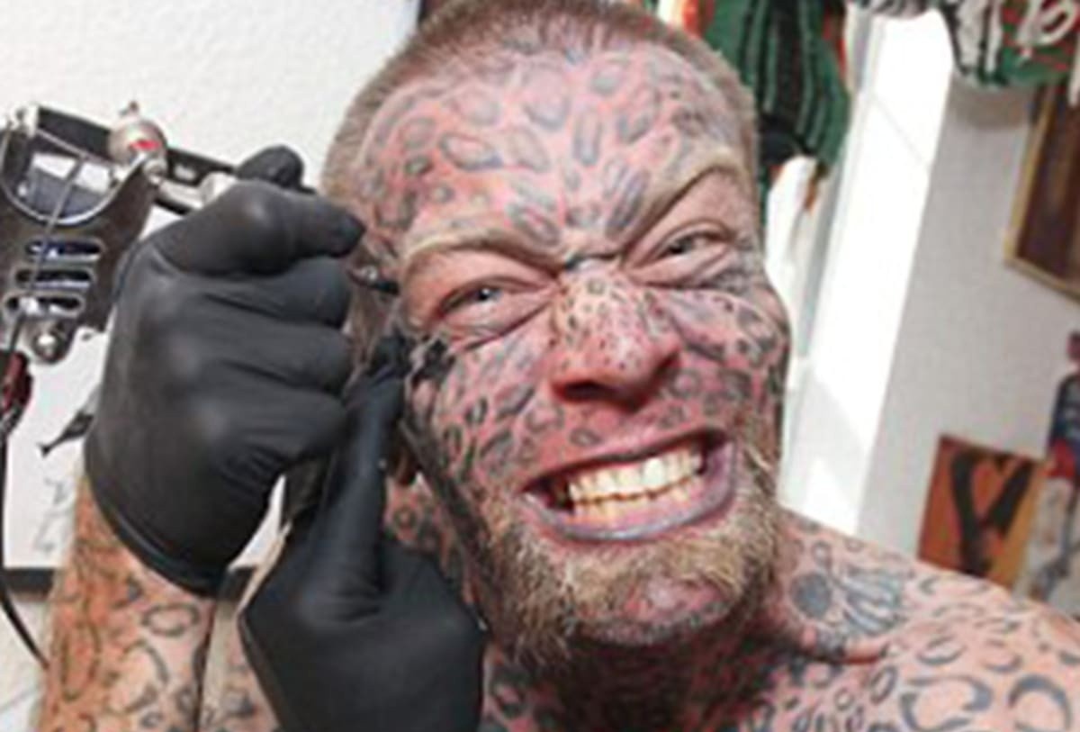 Vi tri xam hinh dau nhat tren co the hinh anh