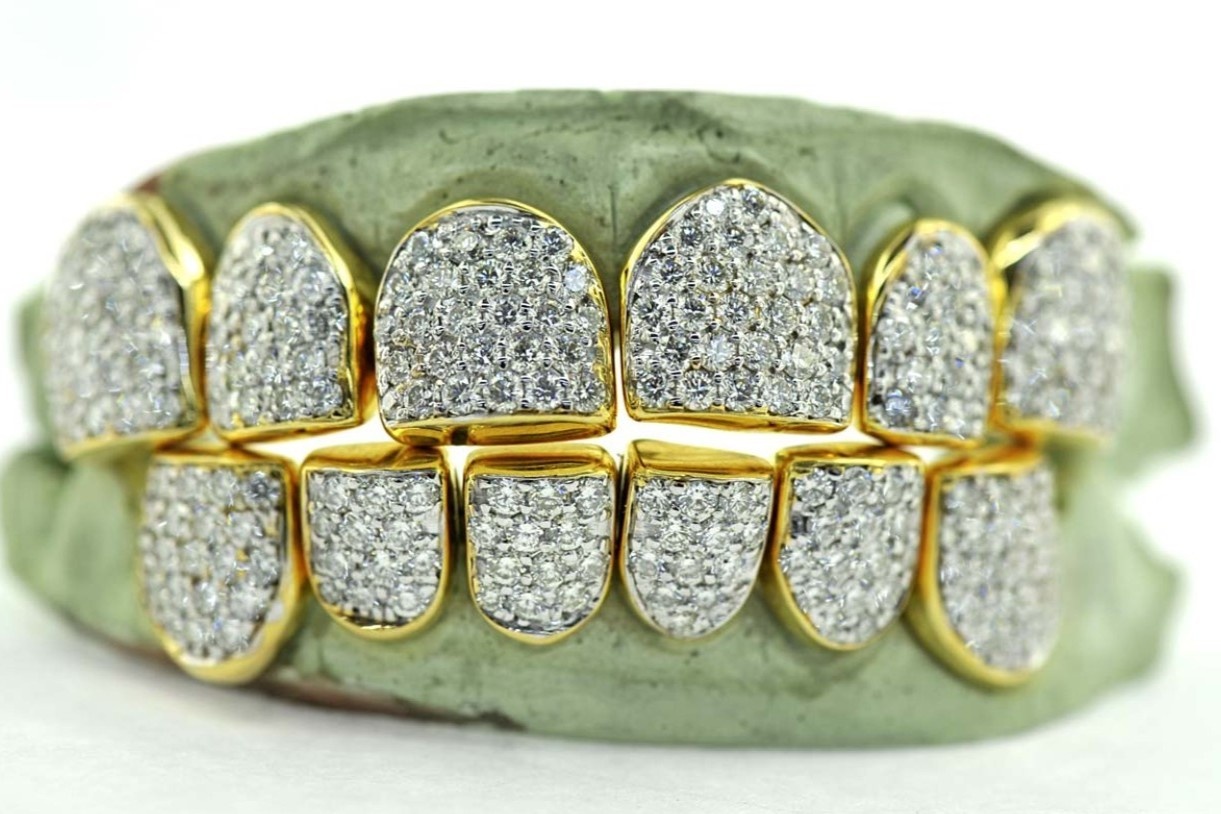 Nhung mau rang vang doc dao cua Johnny Dang hinh anh