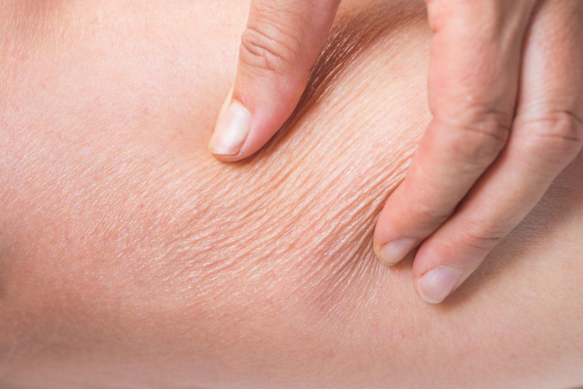 Phan biet da kho va thieu nuoc anh 2