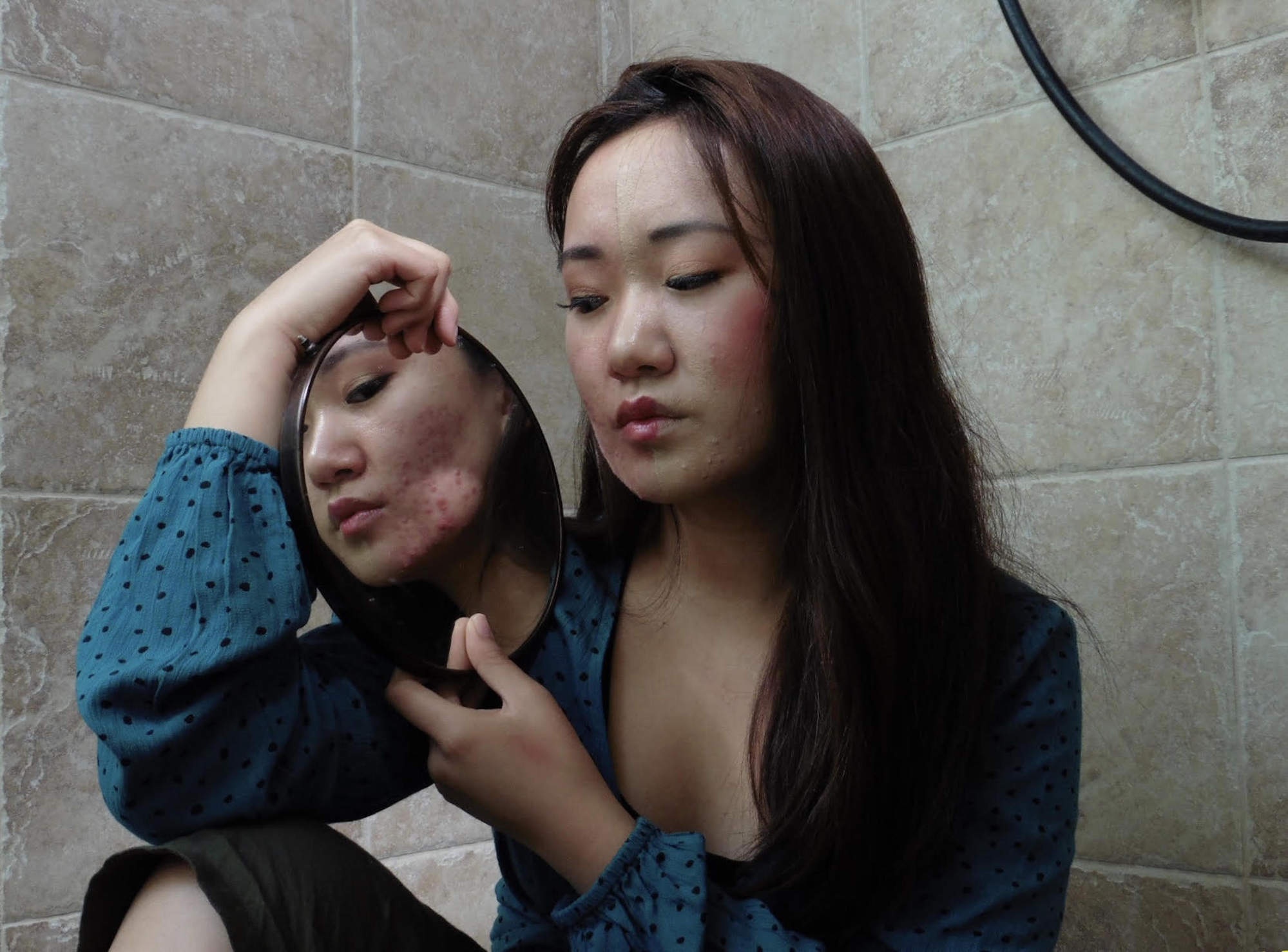 5 ly do khien ban bi mun dai dang anh 3