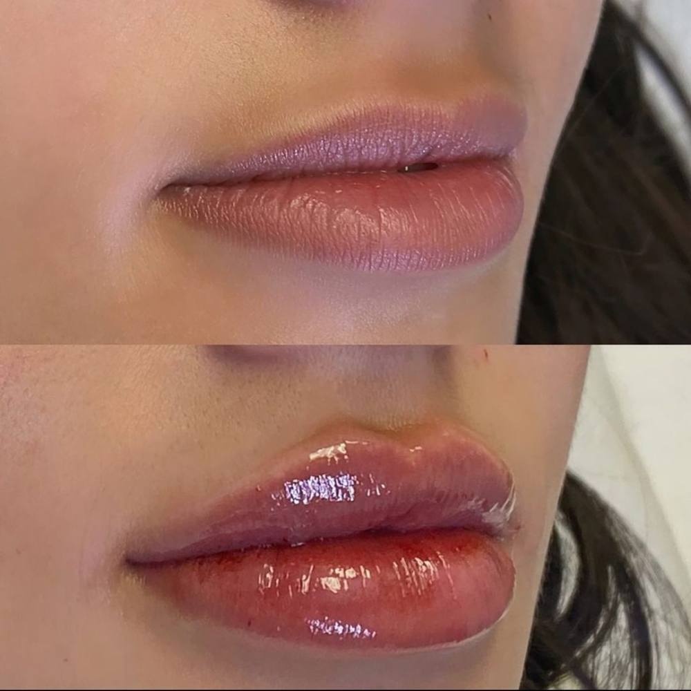 thu thuat lam dep bi bac si tham my tu choi anh 1