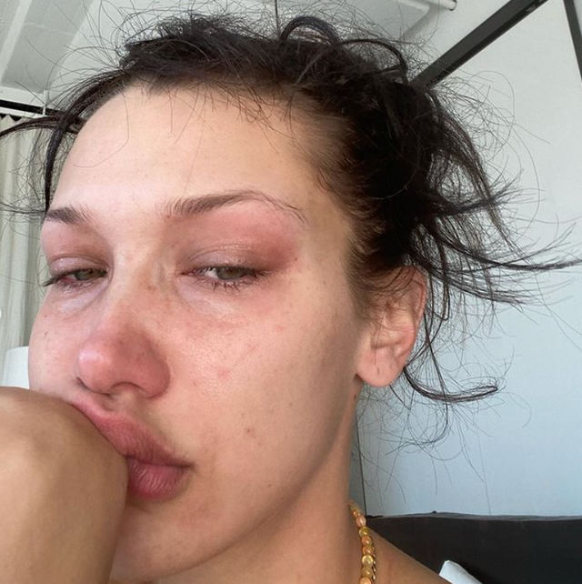 Bella Hadid dừng uống rượu ảnh 2 Bella Hadid dung uong ruou anh 2