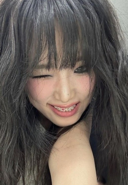 lisa đính đá răng ảnh 3 lisa dinh da rang anh 3