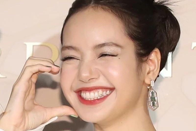 Rui ro khi gan da len rang giong Lisa (BlackPink) hinh anh