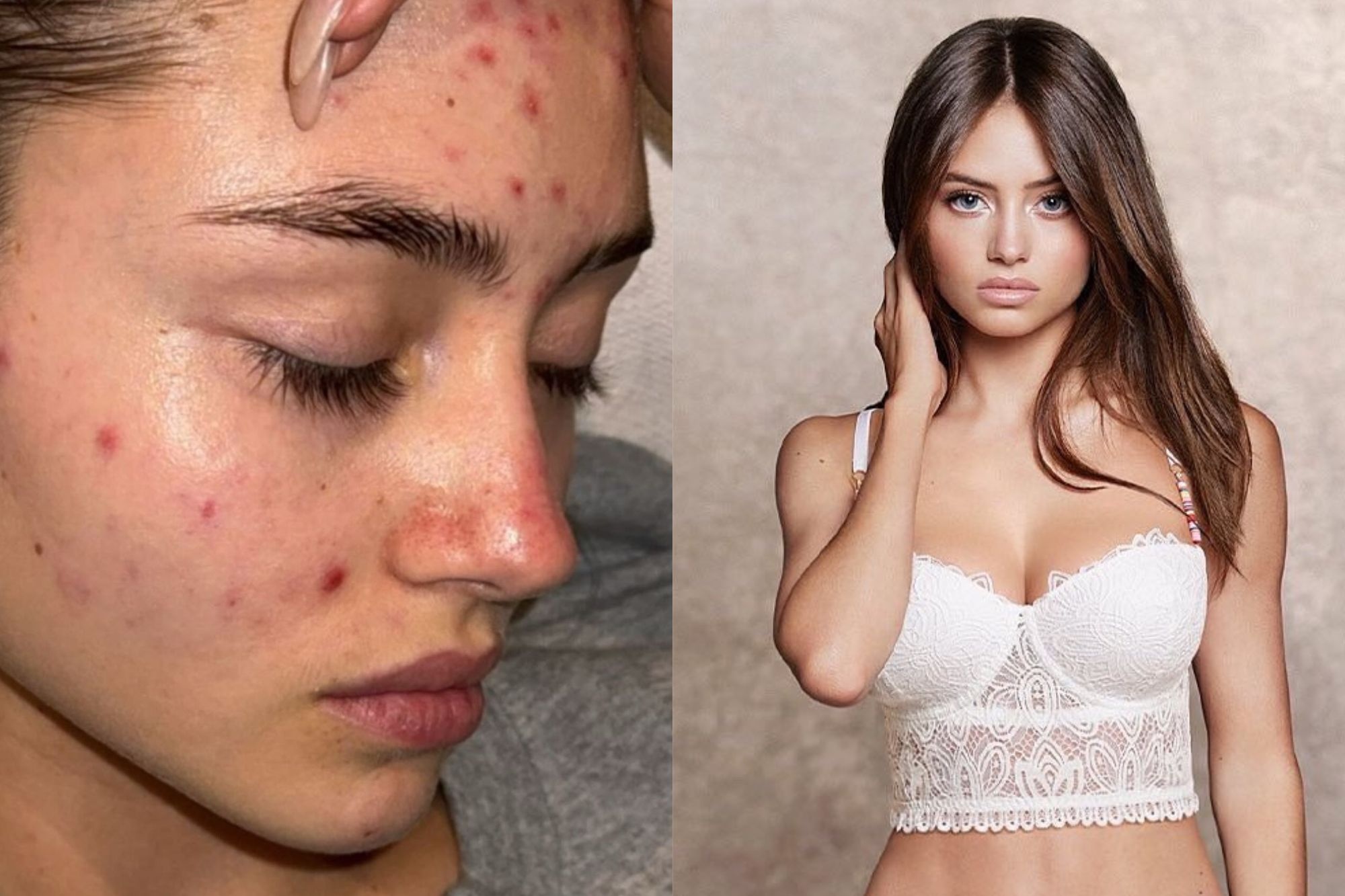 Mat moc cua nguoi mau Leni Klum gay chu y hinh anh