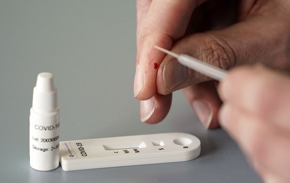 Bo xet nghiem nhanh Covid-19 gia 1 USD se thay doi cuc dien hinh anh