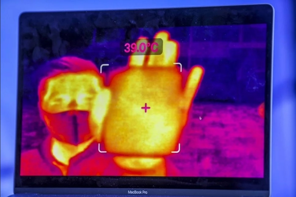 kinh AI phat hien Covid-19 anh 2